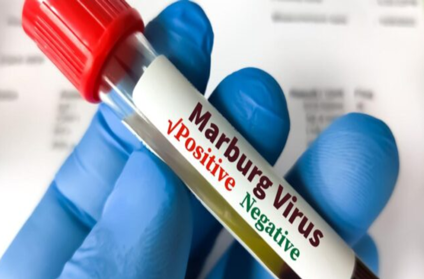 Burundi : La menace mortelle du virus Marburg frappe aux portes du pays